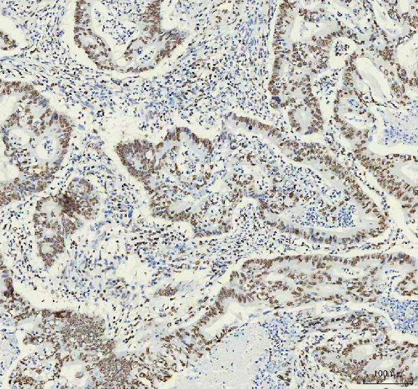 IHC - Anti-HNRNPM Rabbit Monoclonal Antibody ABO16441